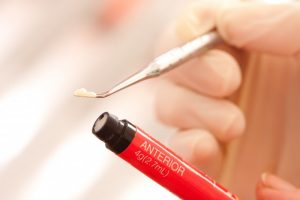 A dentist removing composite resin from a red casing.